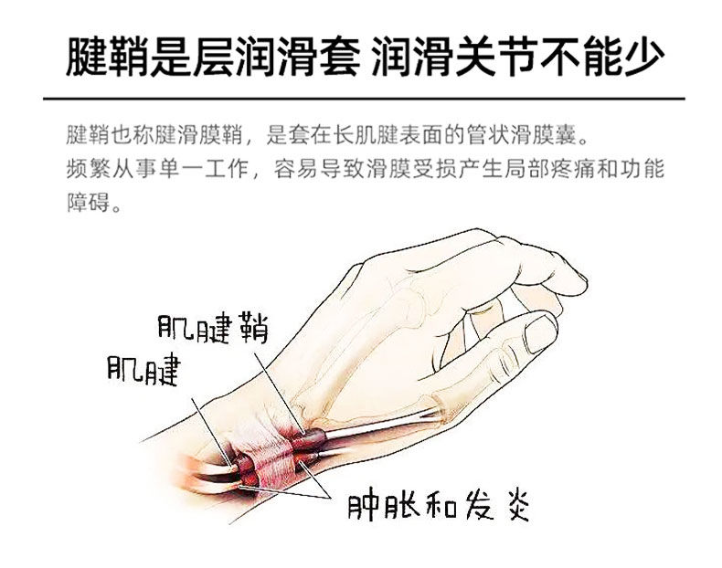 官方旗舰彭氏御方腱鞘炎手腕手指疼痛专用手指贴腱鞘囊肿鼓包伸曲困难