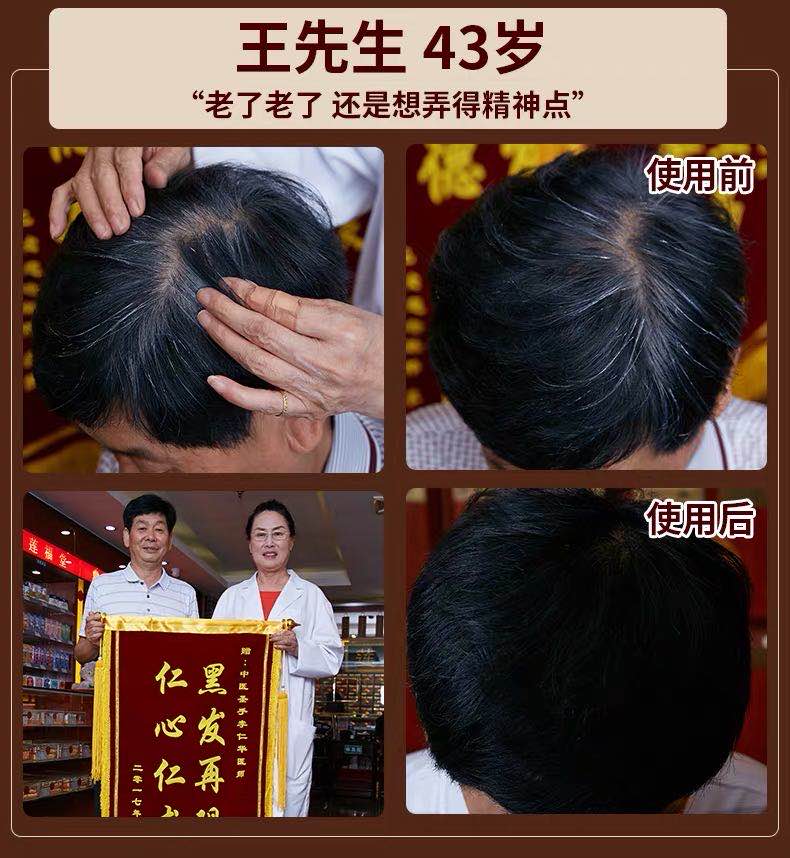 仁和何首乌草本发洗发水少年去白头发治根转黑 买8送10【18瓶装】巩固