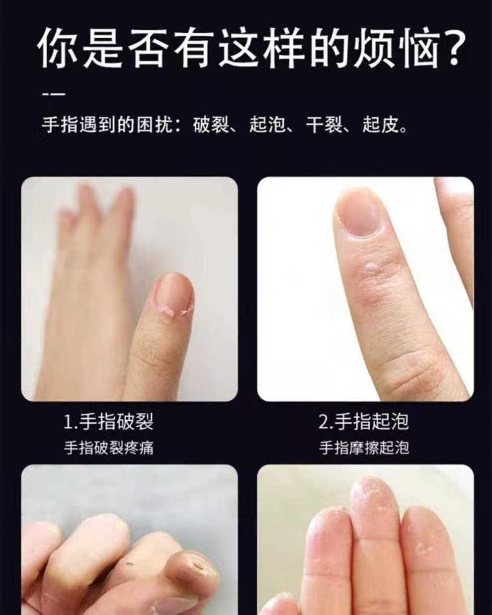 15硅胶手指套防冻防干裂保湿指套保护受伤手指防摩擦防痛开裂口滋润