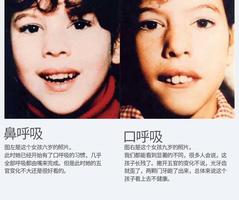 口呼吸闭嘴贴口鼻呼吸矫正贴封嘴闭嘴防止凸嘴地包天变丑打呼噜神器