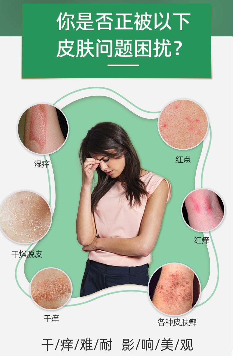 老顽牛百草癣王软膏百草癣王乳膏18g老顽牛百草癣王抑菌膏5盒装