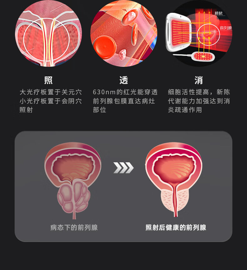 前列腺炎紅光治療儀家用醫用男性多功能男科增生肥大尿頻尿急尿不盡