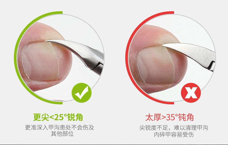 【当季精选】甲沟炎专用指甲刀剪套嵌甲装家用炎脚趾修脚神器鹰嘴钳