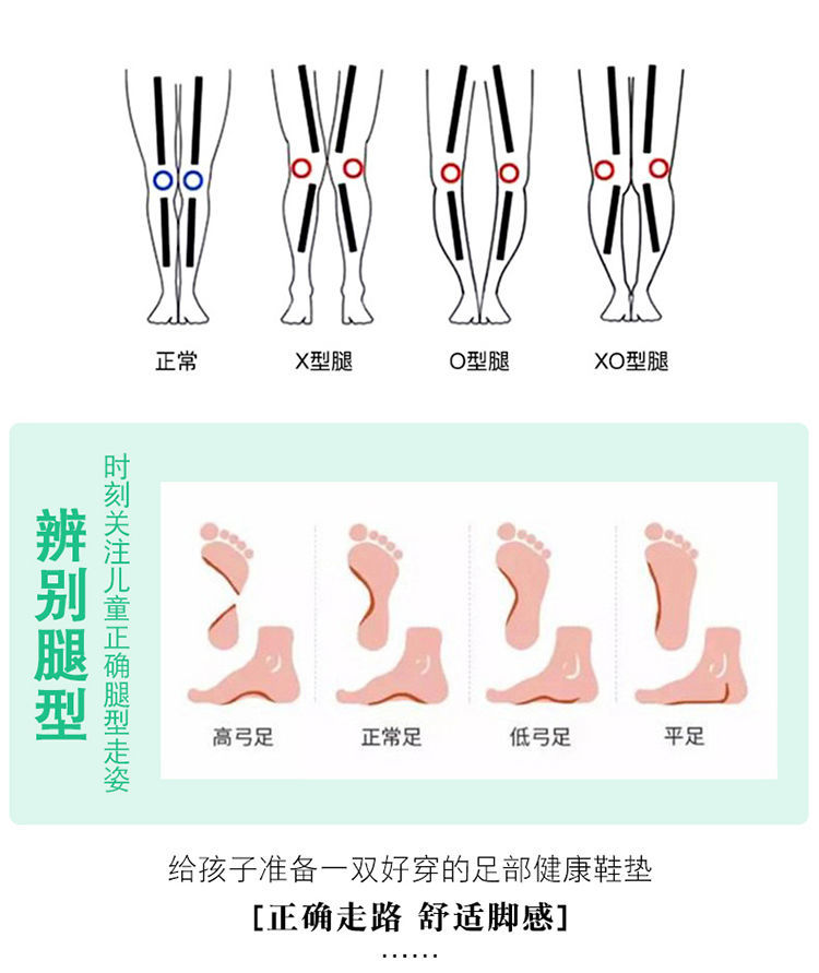 兒童扁平足矯正鞋墊足弓支撐墊防痛護腳內八字足外翻x型腿3-14歲 xs號