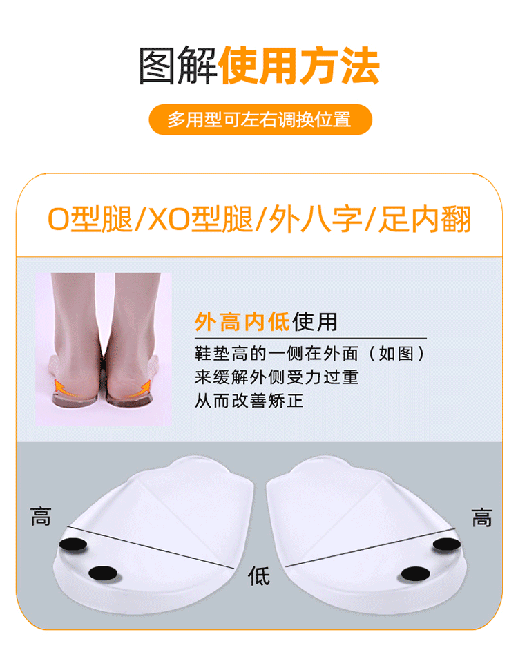 zotoylo型腿矯正器外翻足內翻內外八字腳型x腿型小腿xo直腿成人o型腿