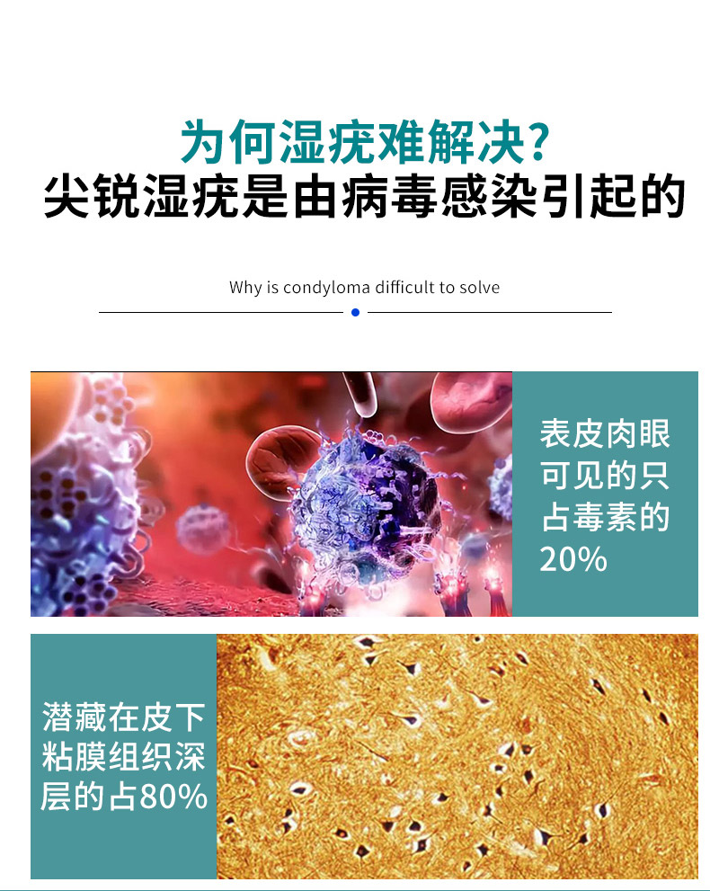 医用清疣凝露尖锐湿疣丝状疣检测hpv病毒男女性私处肛内外阴hpv检测