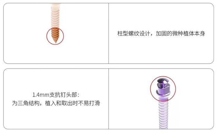 牙科材料 支抗钉 普特 三代五代 彩色支抗钉 齿科 口腔种植工具 手柄