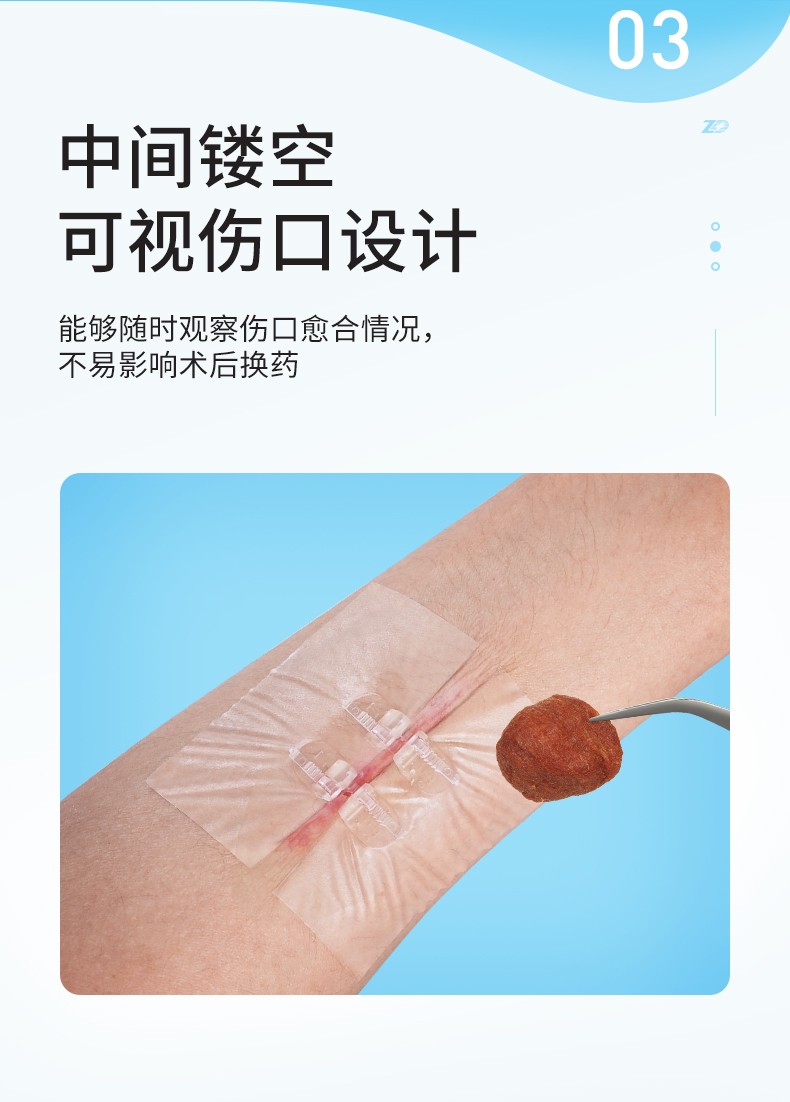 振德zhende皮肤减张器弹性绑带伤口缝合器独立包装免缝针创口贴可视