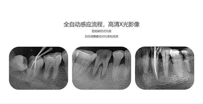 牙科传感器口腔拍照原菲森牙片宝感光板ip板磷光片配德国卡瓦 锐锋
