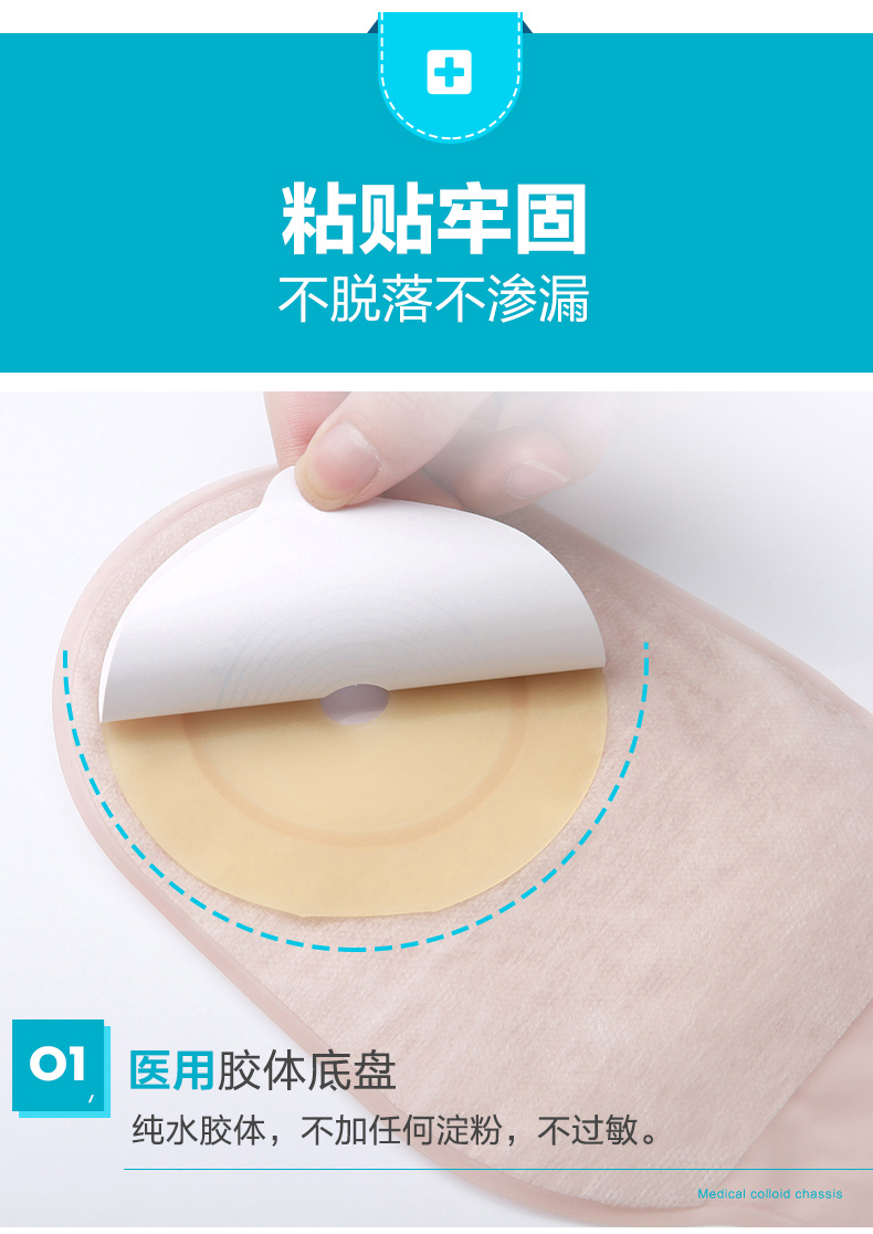 zotoyl一件式肛门直肠改道大便造瘘袋一次性肛袋粪袋口袋肛肠造漏造口