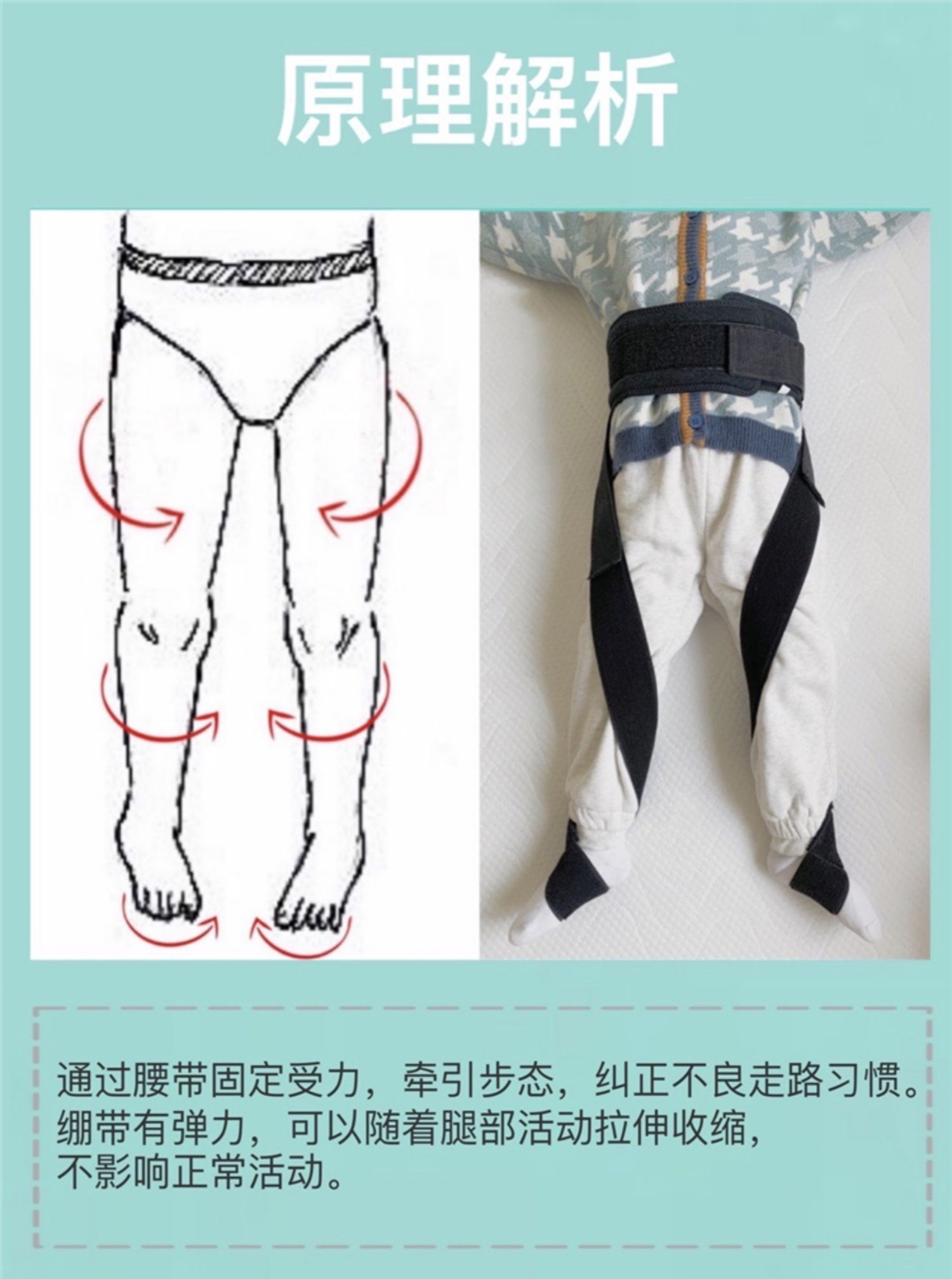 儿童内八字矫正器宝宝脚尖朝内走路姿势纠正足内旋内翻外八矫正带