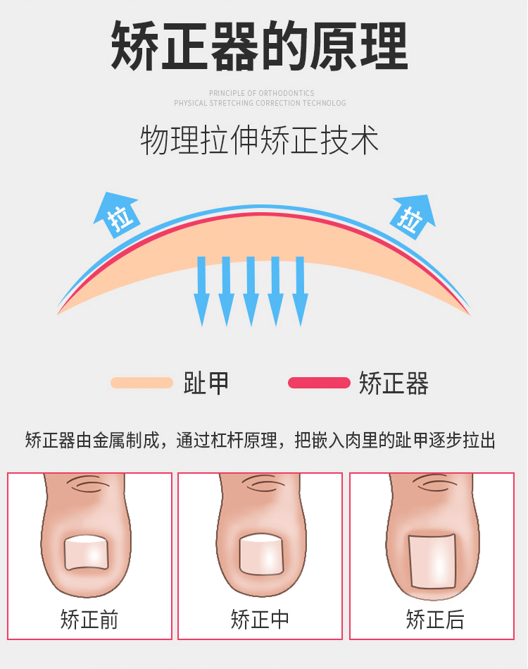 梵匣甲沟专用指甲刀套装修脚神器鹰嘴死皮钳刮脚刀家用脚趾甲剪全套装