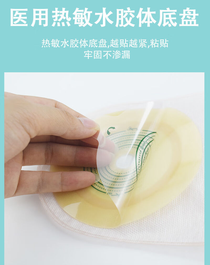 一体式造口袋直肠癌粪袋腰带式一件式造口袋造瘘大便袋扎带款造口袋1