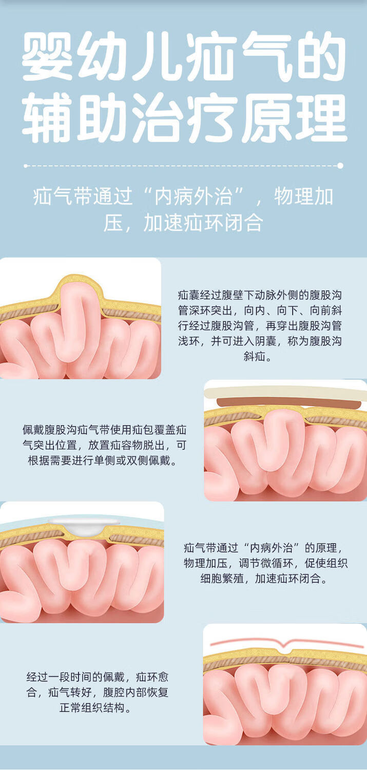 疝气带的制作方法图解图片