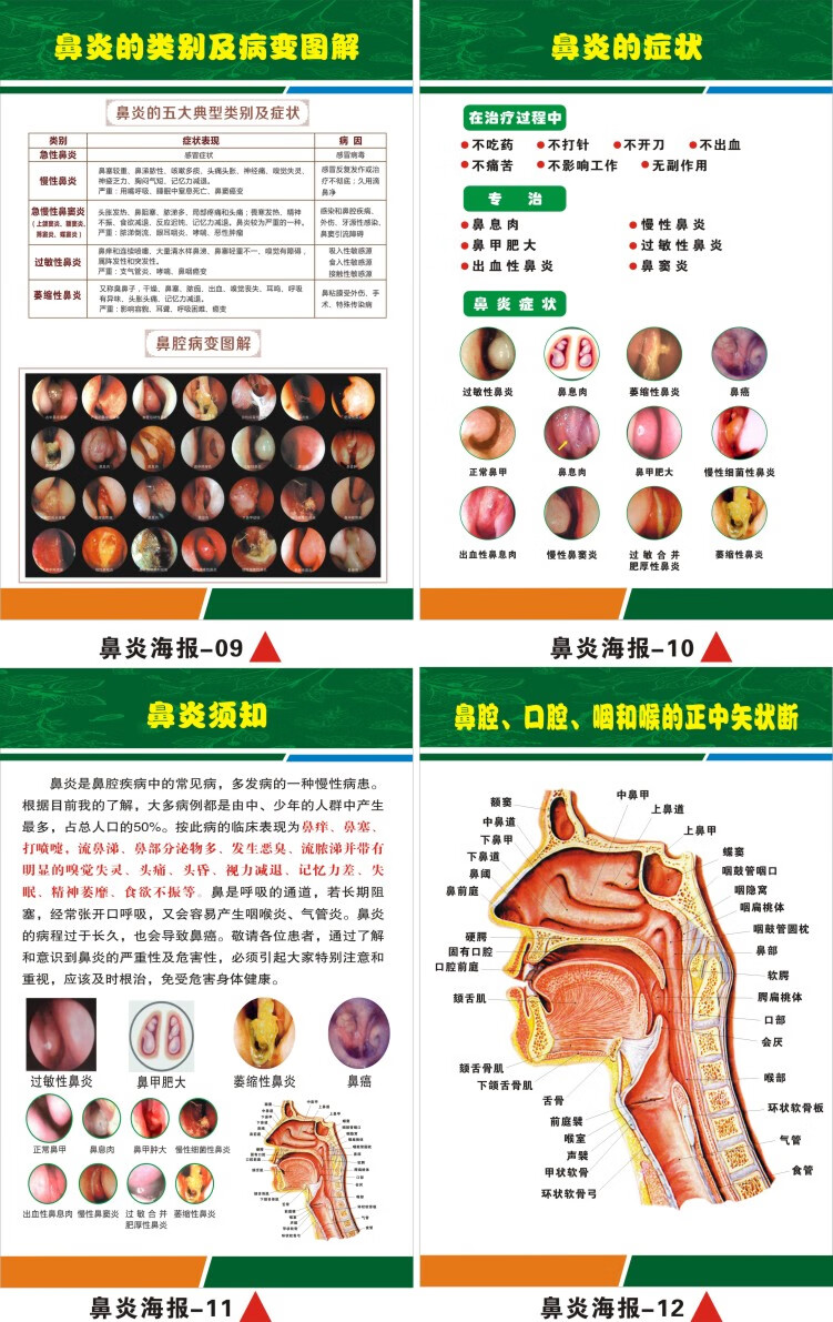 鼻腔结构图解剖挂图耳鼻喉科医院鼻部科普知识海报的症状疾病危鼻炎