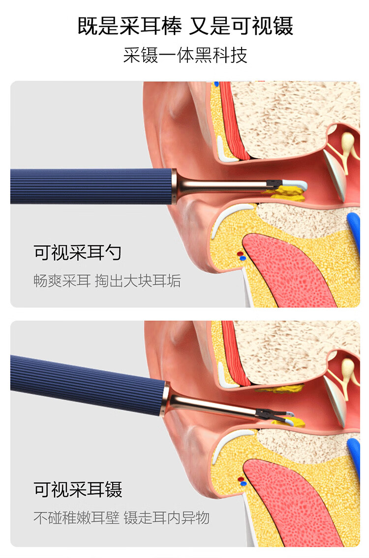 小米有品bebird机械臂智能可视采耳棒采耳镊note3可视挖耳勺掏耳朵