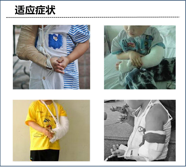 儿童型手臂肘部固定支具上肢肘关节吊带夹板扭伤肱骨支架护托肘关节