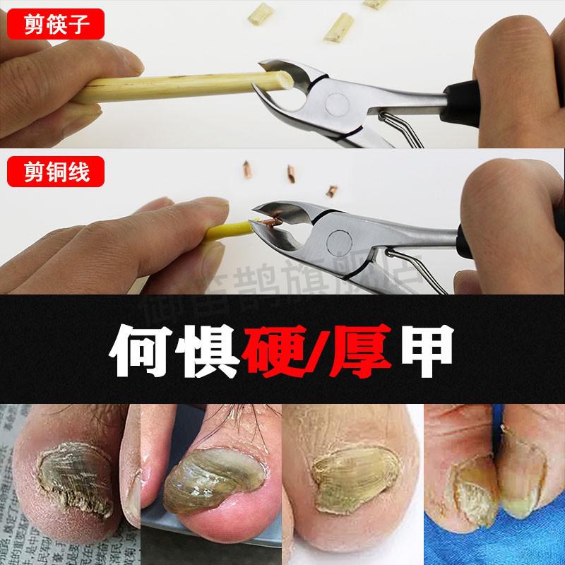 灰指甲修脚锉刀灰指甲修甲专用指甲剪剪灰指甲的剪指甲锉打磨器工具