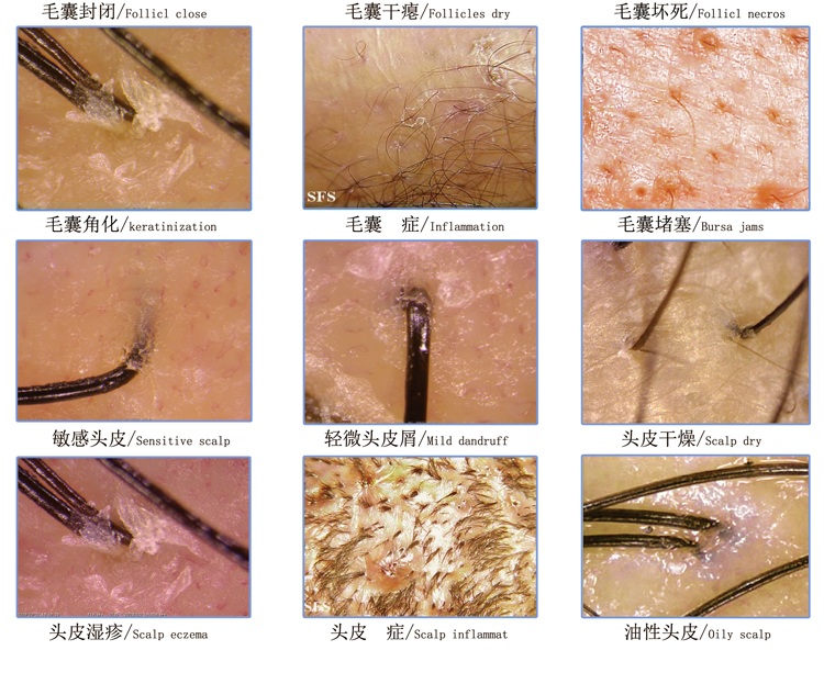 头皮毛囊检测仪头发脸部皮肤分析仪器理发店高清带式15寸标准款四格