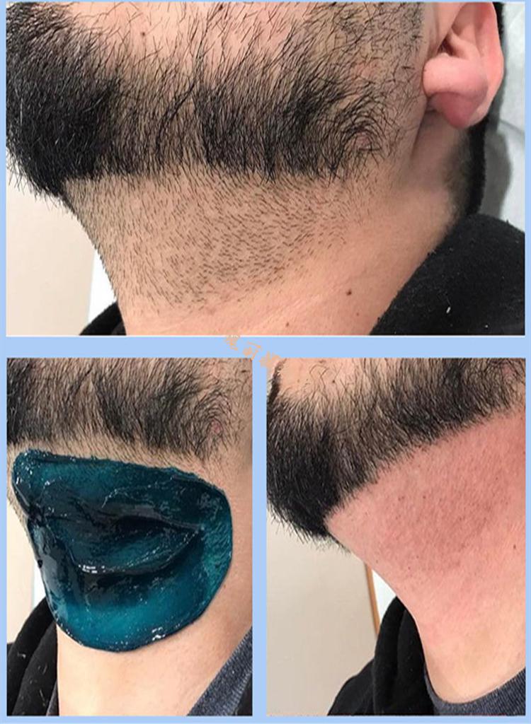 拔胡子胶 男士脱胡子去根撕拉式连根拔起半拔胡须脱毛神器把去 (套餐