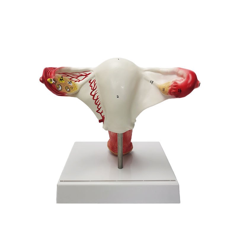 人体子宫模型教具模具卵巢解剖病理医学女性仿真女性生殖模器 病理