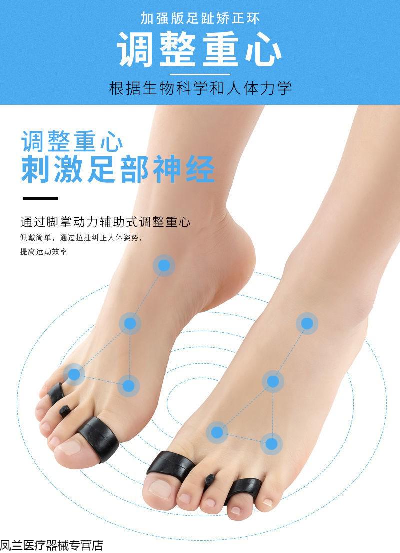 大山腿型足趾环脚拇指o型腿脚趾环瘦脚神器外翻纠正单只装粉色 1倍 图片价格品牌报价 京东