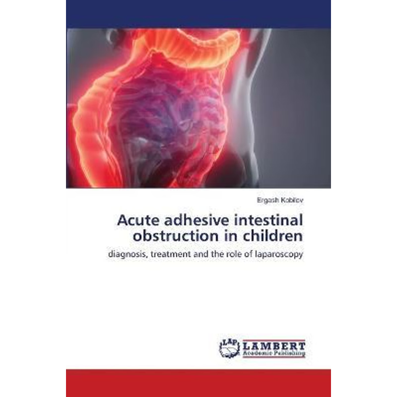 按需印刷Acute adhesive intestinal obstruction in children[9786202667500]