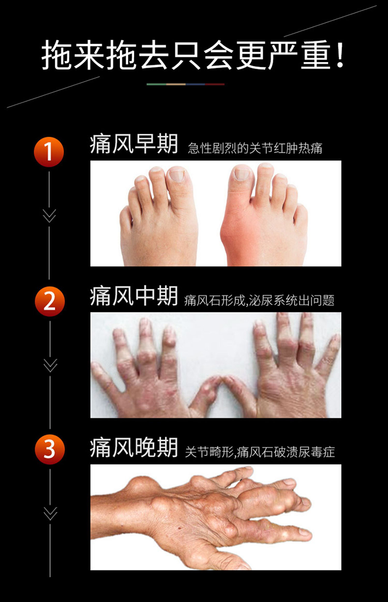痛风喷剂痛风贴医用冷敷贴痛风膏贴脚趾踝关节肿胀外