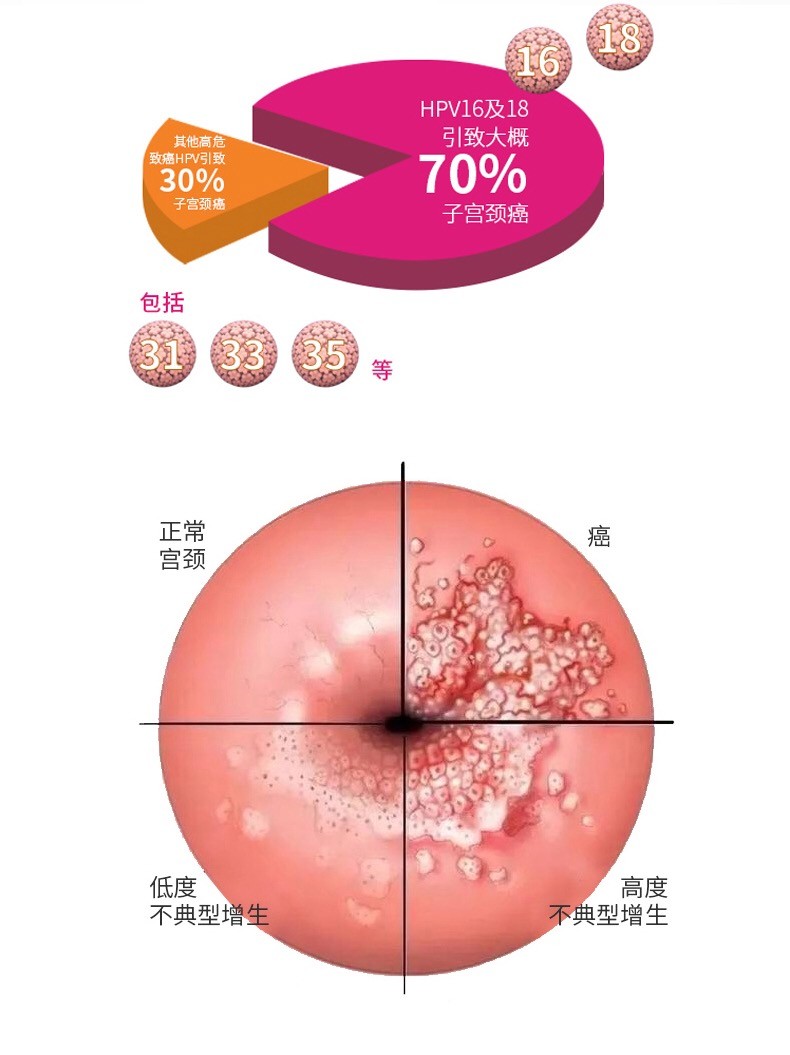 葆佩寇抗hpv生物蛋白微葆冷敷凝胶佩蔻抗hpvβ乳球蛋白宫颈填露三盒装