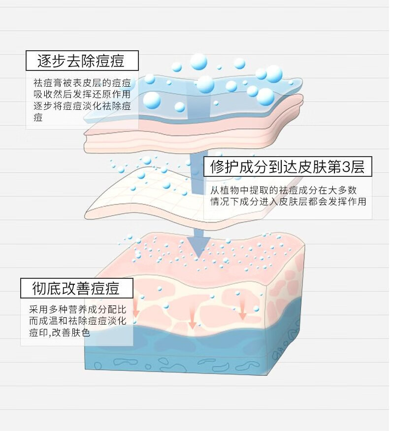 花恩诗 花恩诗祛痘膏针对痘印痘坑黑头粉淡化粉刺黑头控油青春祛痘霜 1支体验装【净痘淡印，保湿滋润