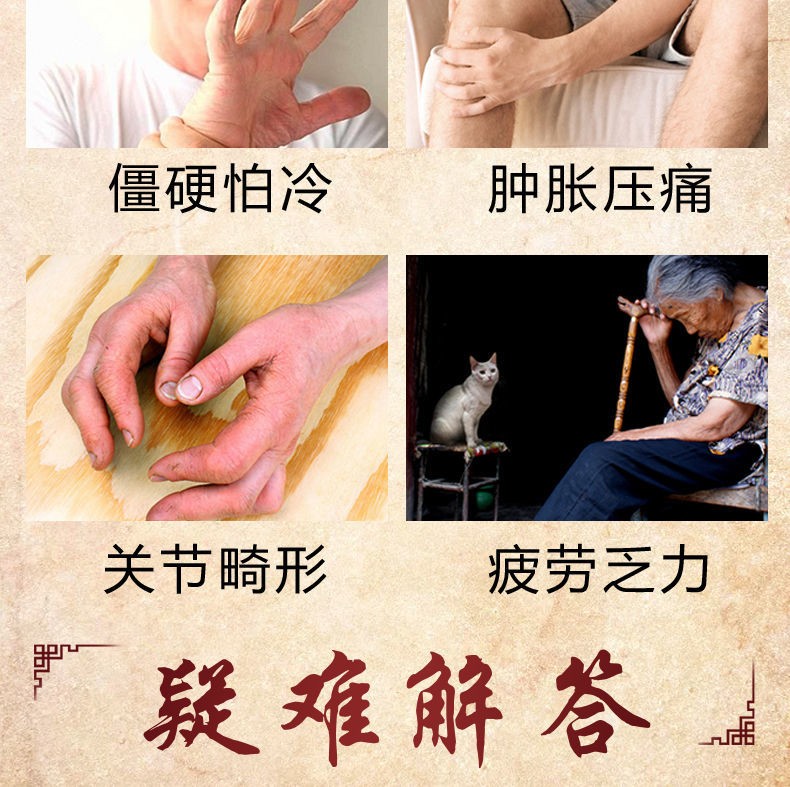 蕴祥手指关节贴