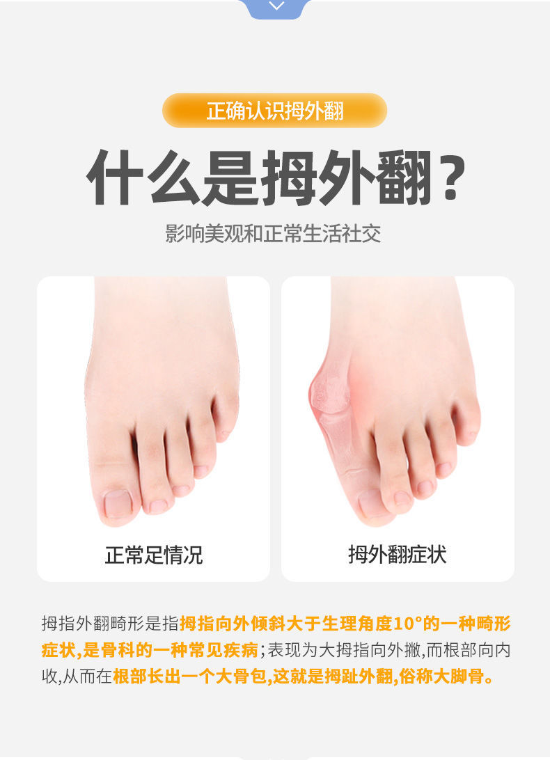 拇外翻脚趾外翻大拇指外翻内翻大脚骨足外翻脚趾重叠 1只夜用款(左脚)