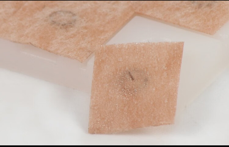 环球一次性揿针皮内针耳针嵌针耳贴针100支盒02520mm100支盒