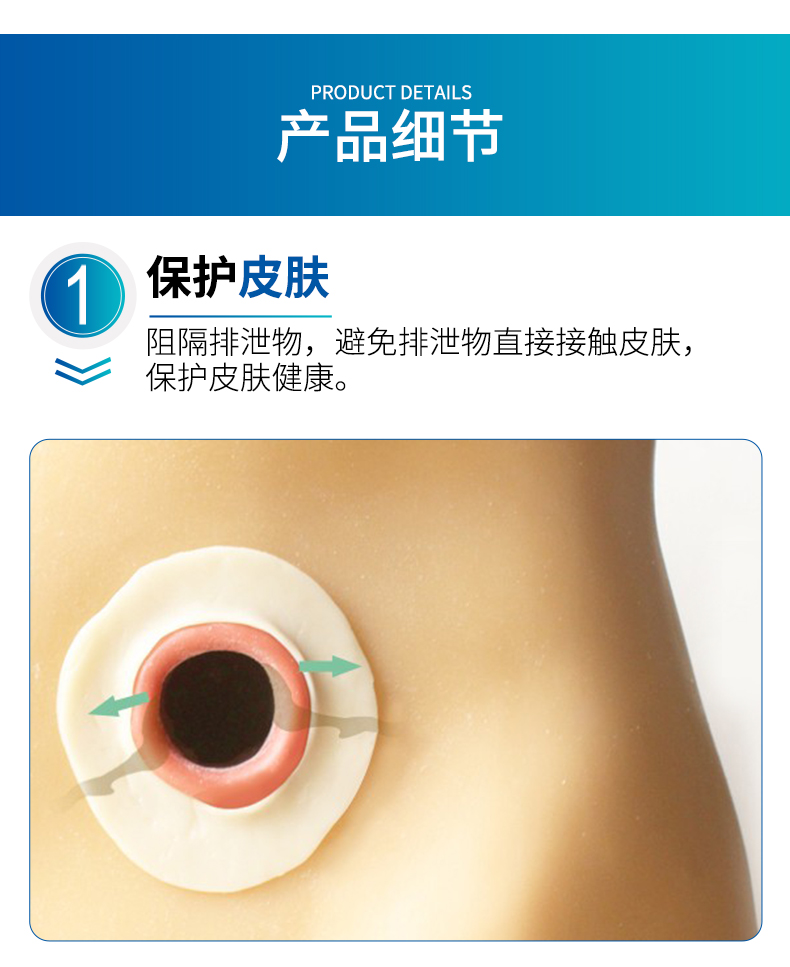 防漏圈 造口可塑防漏贴环护理用品 造口袋防漏条替代防漏膏 一盒10个