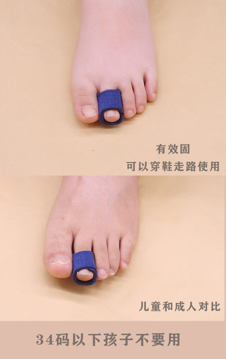 脚趾前关节下垂弓起内扣固定锤头趾康复弯曲重叠食指可走路sn3292 s号
