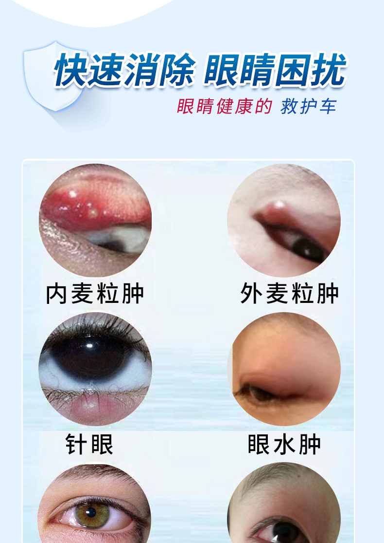 米娜丝四号4号内外麦粒肿针眼眼浮肿水肿眼水链接 体验装1盒 图片