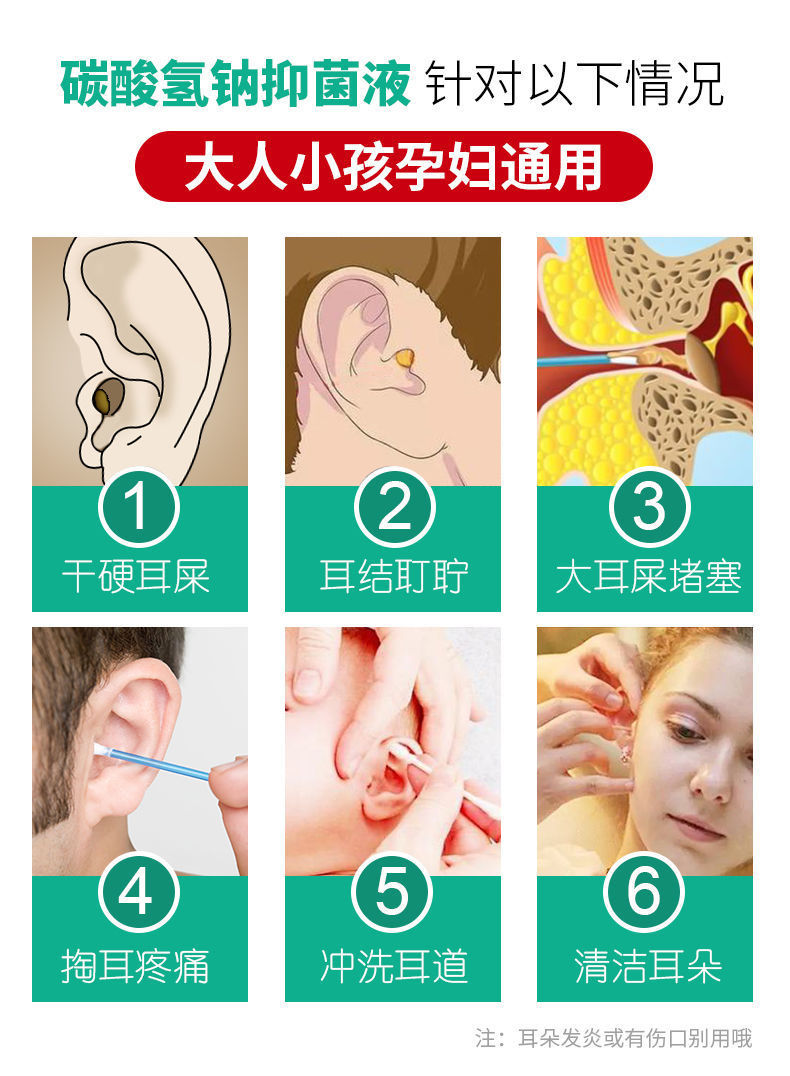 碳酸氫鈉滴液人用耳朵清潔耵聹水耳結石耳屎軟化劑2支裝發光耳勺棉