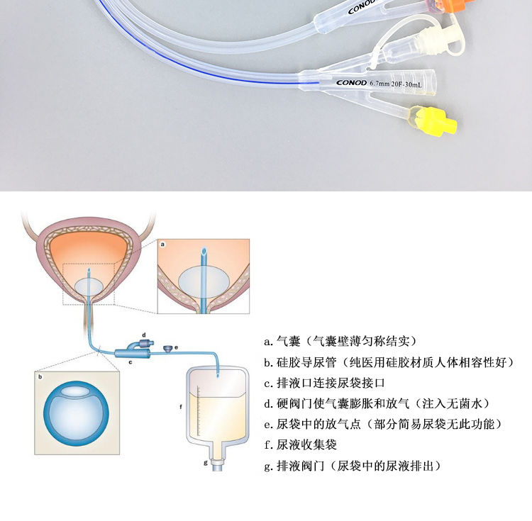 三腔尿管原理图图片