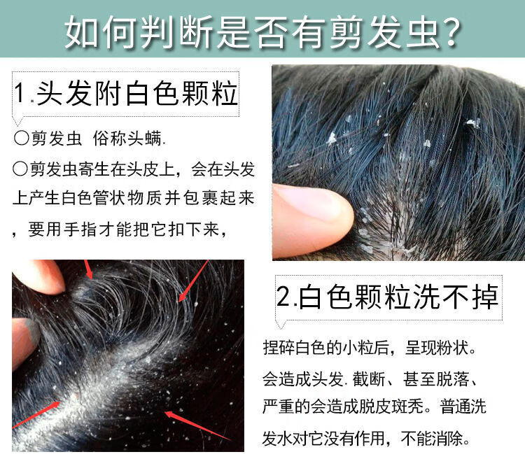 剪发虫洗发水男女儿童专用硫磺皂洗头液控油去屑止痒除螨洗护发膏4