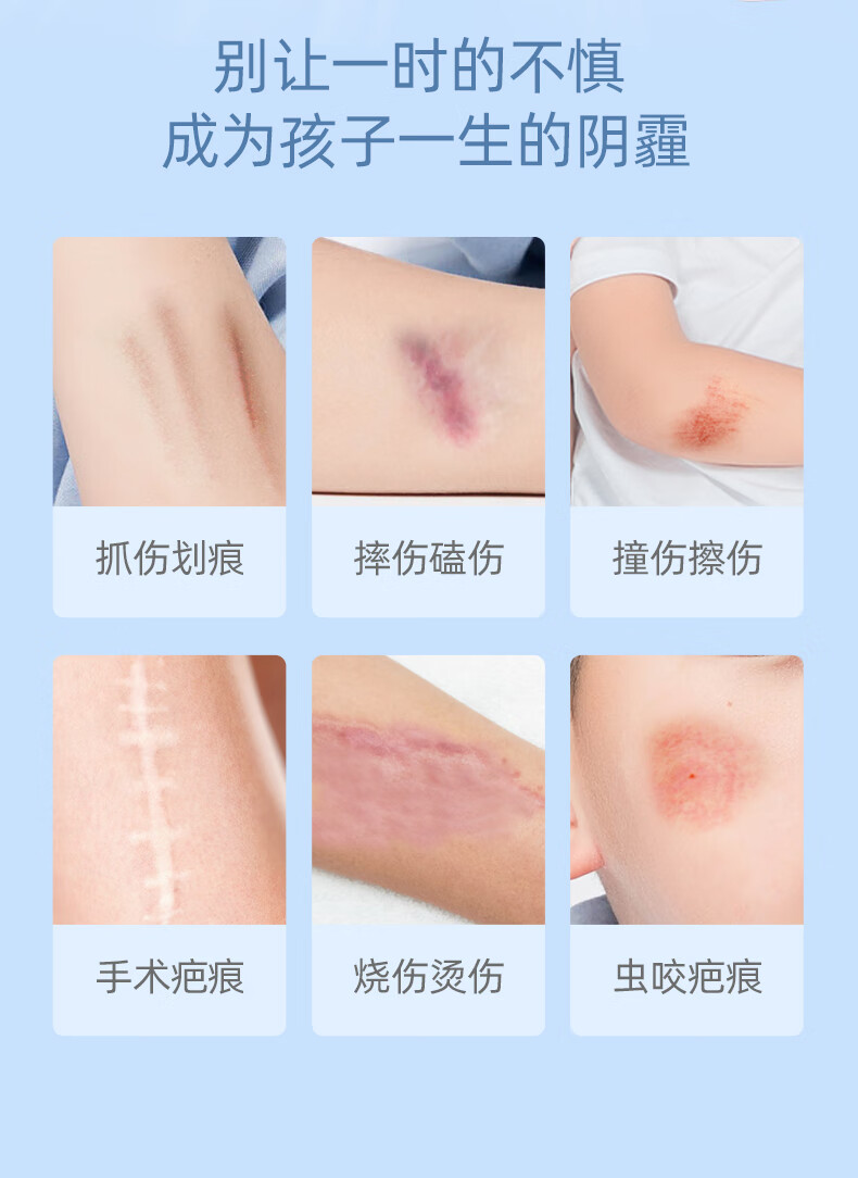去疤痕平儿童专用小孩脸部疤痕修复淡化克烫伤儿童专用疤痕平15g支