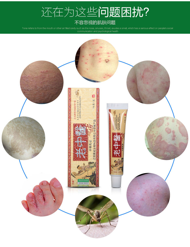 老中医乳膏皮肤病全身皮炎膏皮肤瘙痒牛皮癣苗王 5盒装【图片 价格