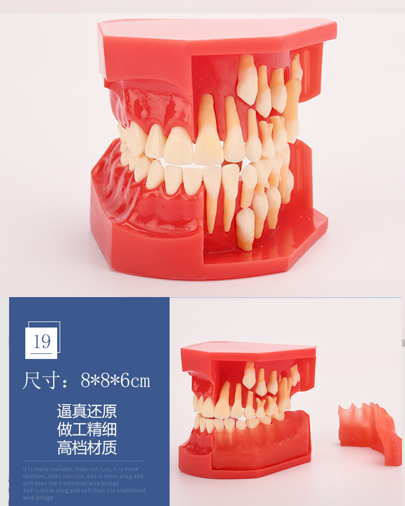 牙齿模型口腔医院教学 正畸种植修复可拆卸蛀坏龋 假牙科摆件道具 4号