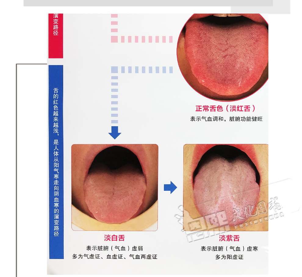 中醫臨床舌診掛圖診舌色診舌苔診紅點與瘀點診舌下絡脈與瘀斑河南科學