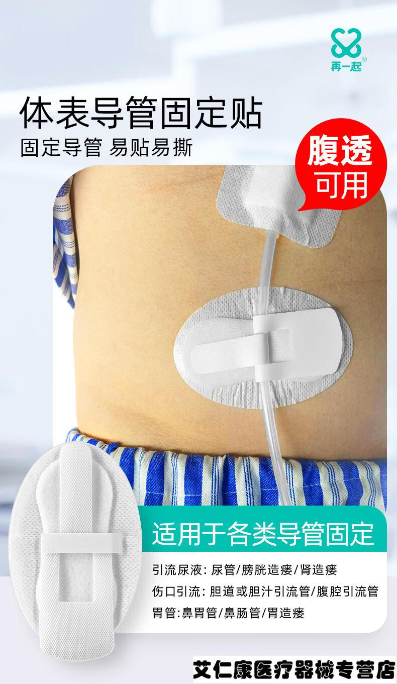 胃造瘘管固定器图片