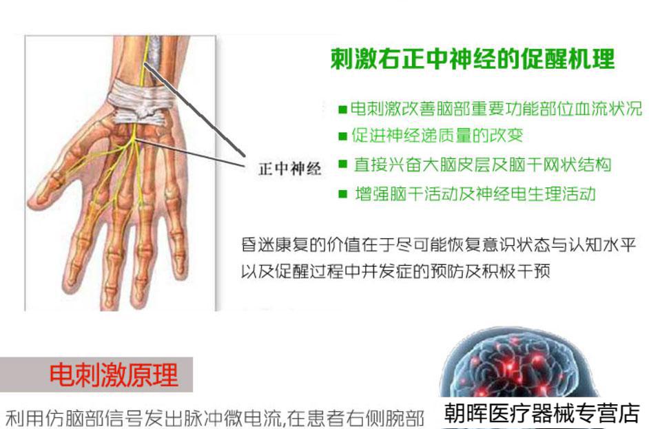 正中神经损伤表现为图片