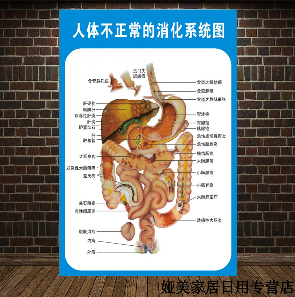 可狄kedi新款人体消化肠道结构示意图医学宣传挂图人体器官布置图人体