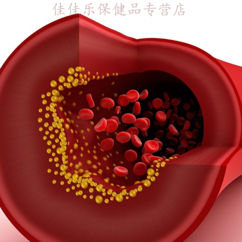 美国life extension 低高密度脂蛋白 载脂蛋白a 胆固醇 血脂