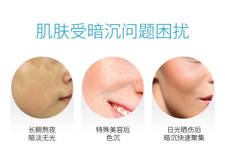 优斐斯（uface）传明酸精华液 氨甲环酸原液 改善暗沉提亮肤色 面部护肤品 4ml体验装