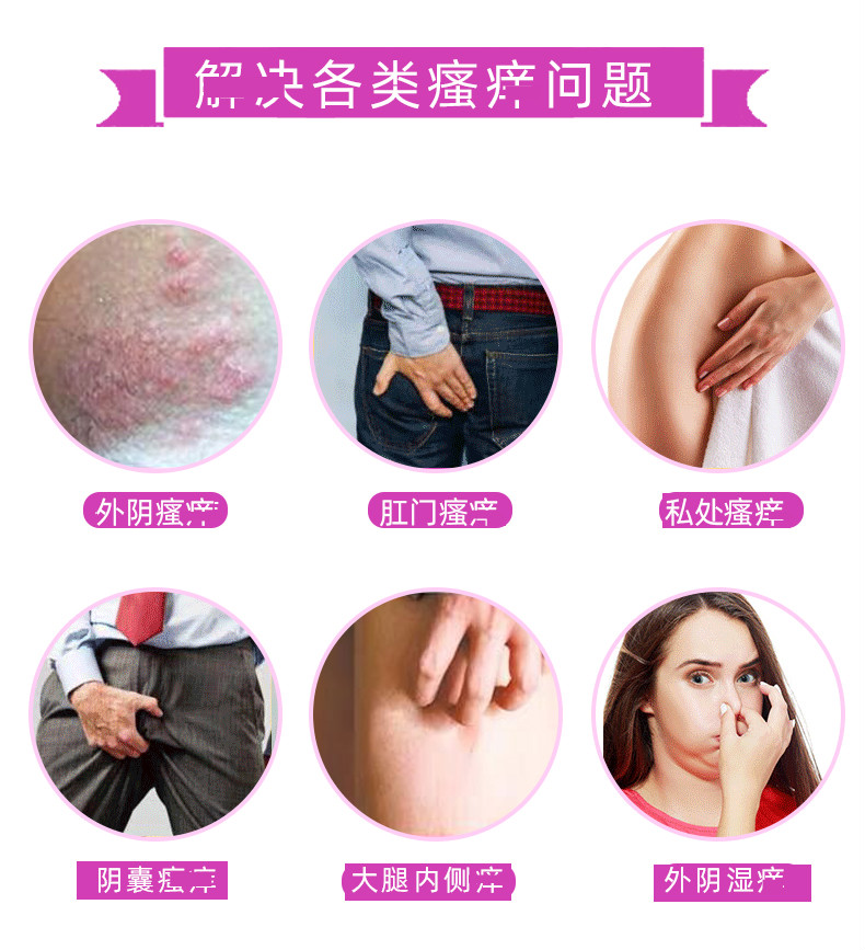 阴舒宁女性私处瘙痒膏舒痒宁护理膏舒阴膏肛门瘙痒护理诗莱格 舒阴膏1