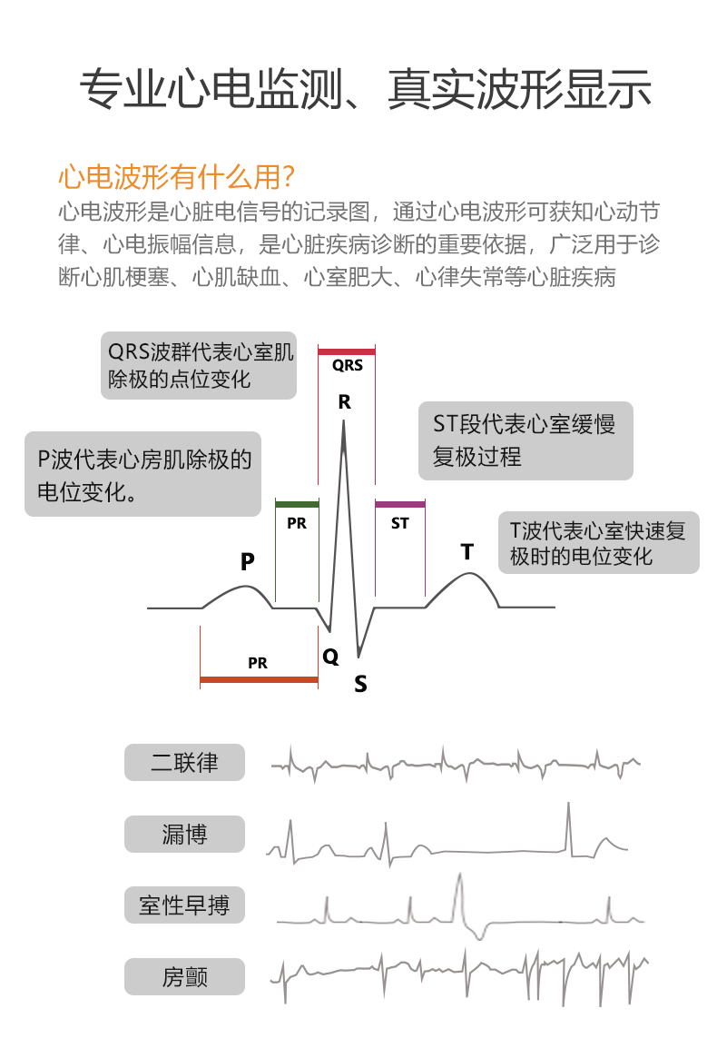 力康心电图机家用心脏监护检测仪24小时便携式记录仪holter含血氧监测